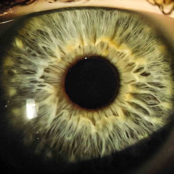 Iris Auge 9